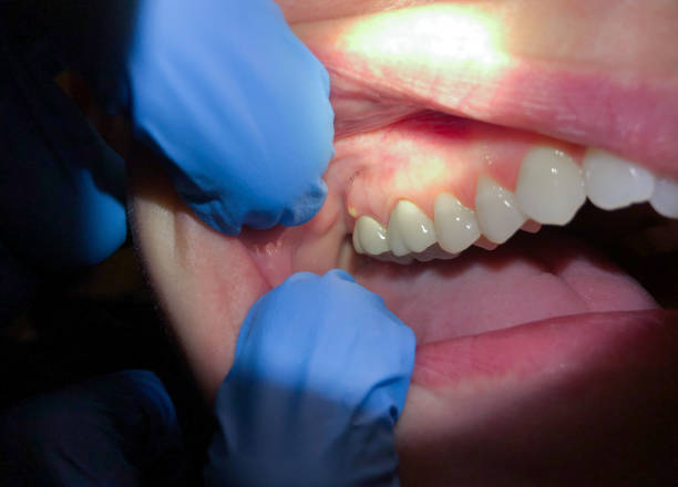 Best Broken or Cracked Tooth Emergency Dentist in Dayton, TX